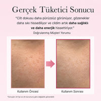 Arencia PDRN Booster Shot - Yenileyici Serum 30ml