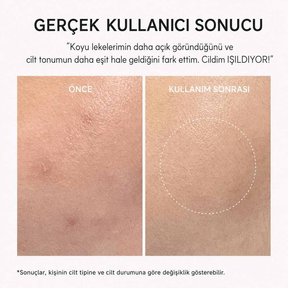 Arencia TXA Booster Shot - Leke Karşıtı 30ml