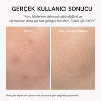 Arencia TXA Booster Shot - Leke Karşıtı 30ml