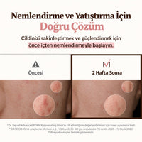 Dr.Reju-All Advanced PDRN Rejuvenating Mask - PDRN İçeren Yenileyici ve Onarıcı Yüz Maskesi 36ml (1 Adet)