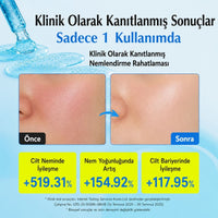 EQQUALBERRY Hyaltoin Flooding Serum - Yoğun Nem Bakım Serumu 30ml