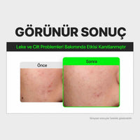 FATION Rapid Calming Serum - Yatıştırıcı Serum 30ml