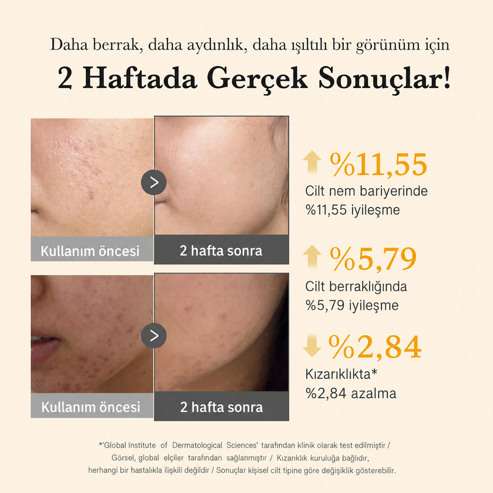 Medicube Kojic Acid Turmeric Niacinamide Serum - Leke Karşıtı 30ml