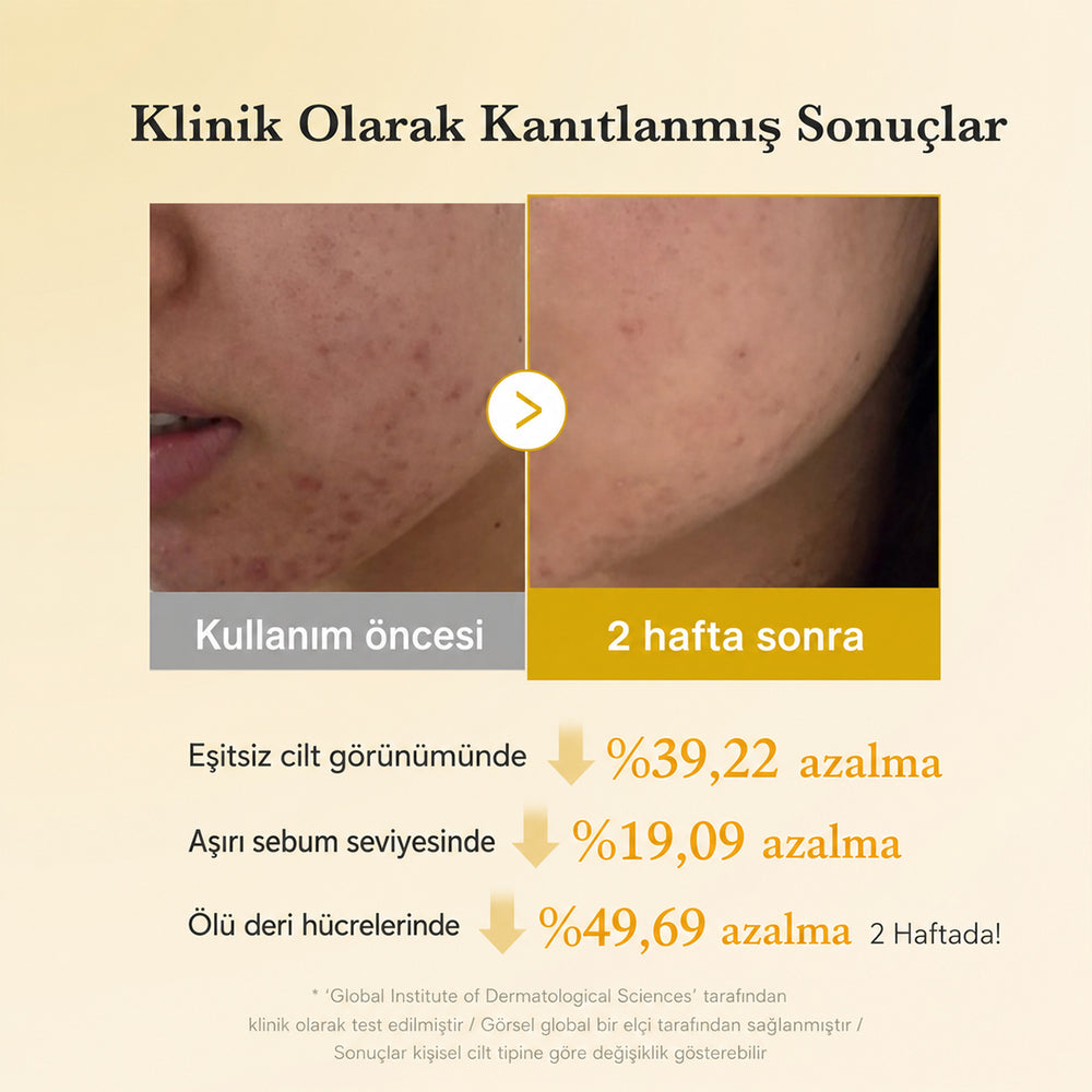 Medicube Kojic Acid Turmeric Toner Pad - Leke Karşıtı 70 Adet