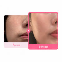 Medicube Ultra Light PDRN Pink Peptide Serum - Yaşlanma Karşıtı 30ml