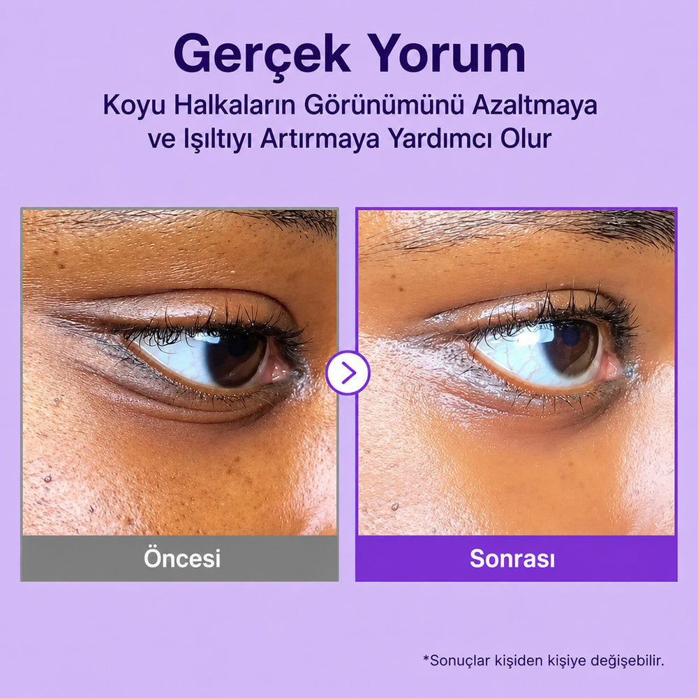 Numbuzin No.9 NAD+ Retinol Eye Cream - Göz Kremi 10ml
