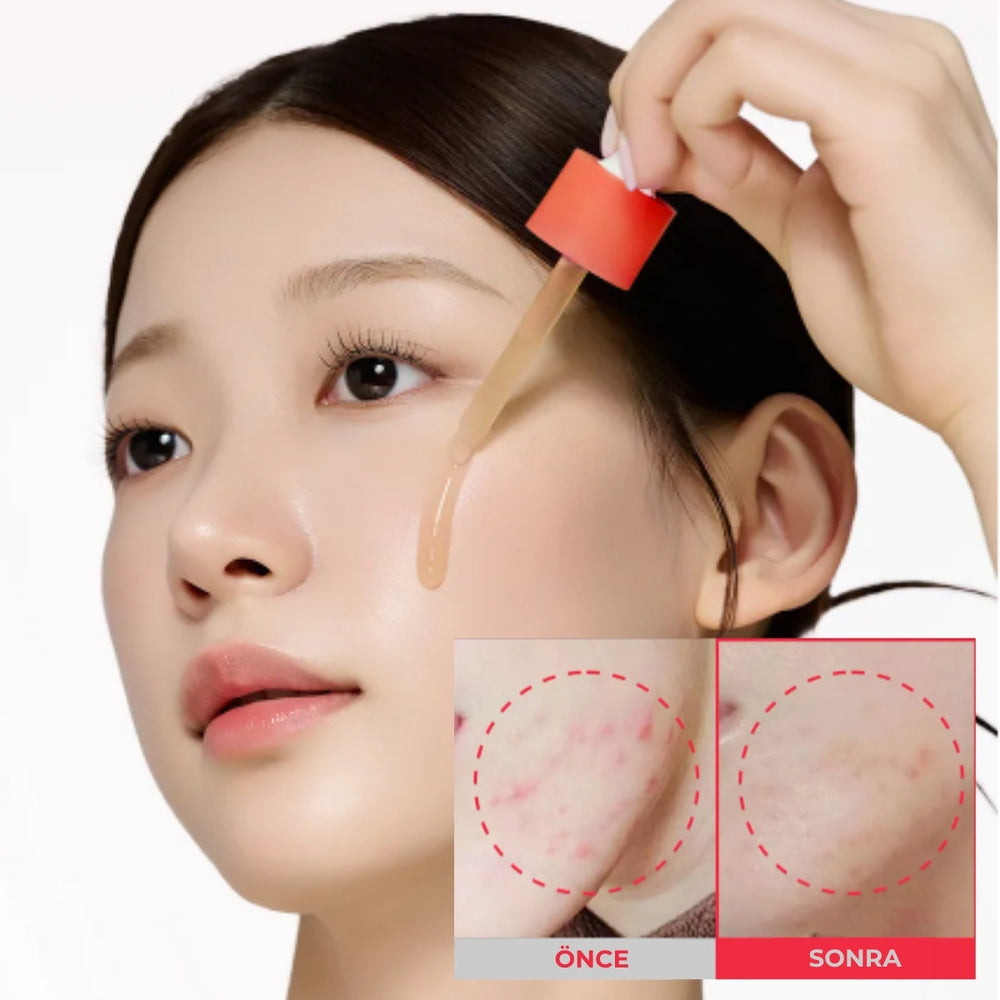 Sungboon Red Heartleaf BHA-Lino Ampul - Dengeleyici Ampul 40ml