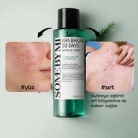 SOME BY MI AHA-BHA-PHA 30 Days Miracle Toner - Gözenek Toniği 150ml