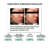 SOME BY MI AHA-BHA-PHA 30 Days Miracle Toner - Gözenek Toniği 150ml