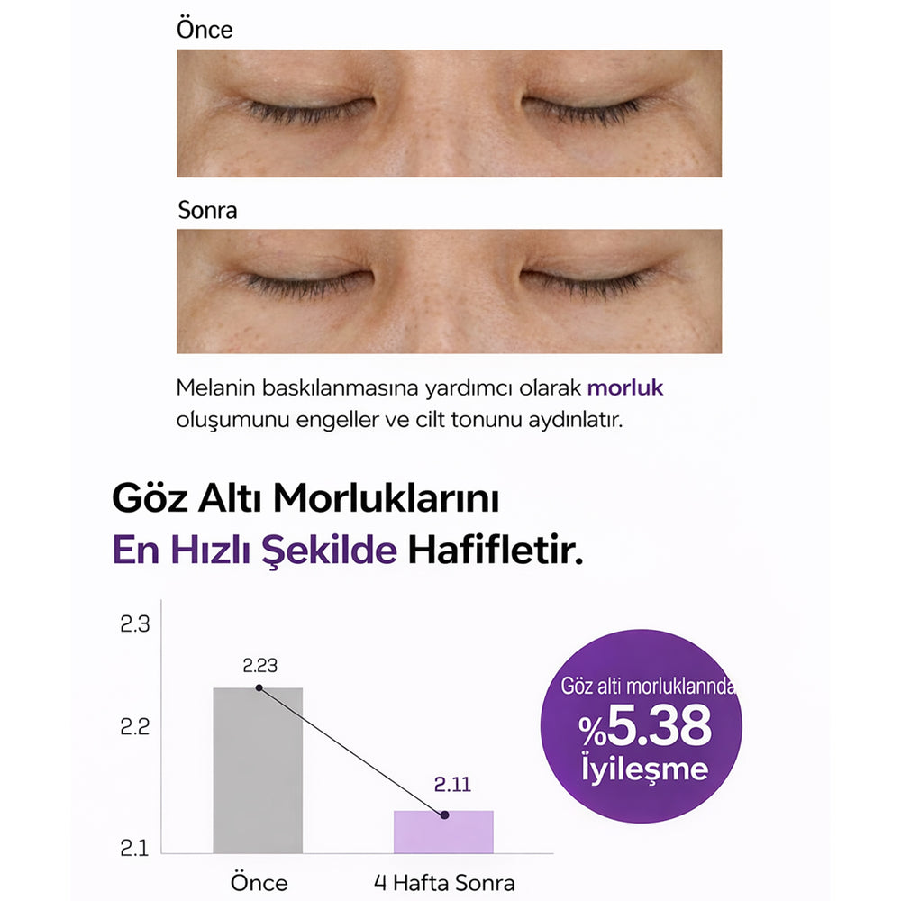 SOME BY MI Retinol Intense Advanced Triple Action Eye Cream - Retinol Göz Kremi 30ml