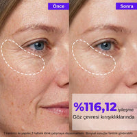 Sungboon Silk Peptide EGF Gold Mask - Sıkılaştırıcı 4 Adet