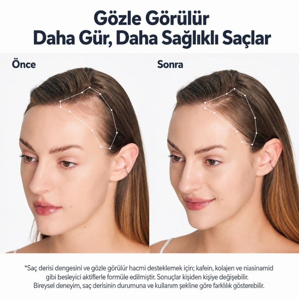 Sungboon Deep Collagen Retinol Power Boosting Scalp Serum - Saç Güçlendirici 15ml