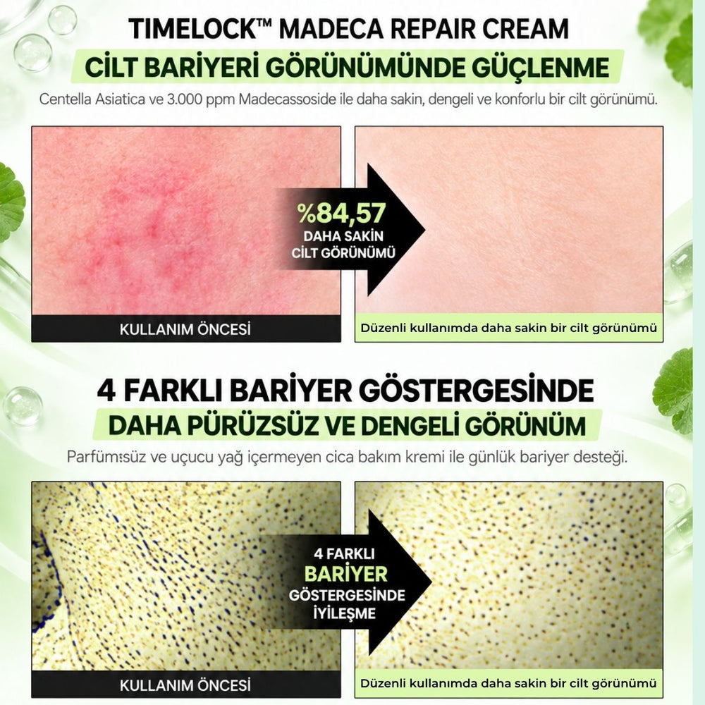Vionine TIMELOCK™ Madeca Repair Cream - Centella Asiatica Cica Bariyer Kremi 30 ml