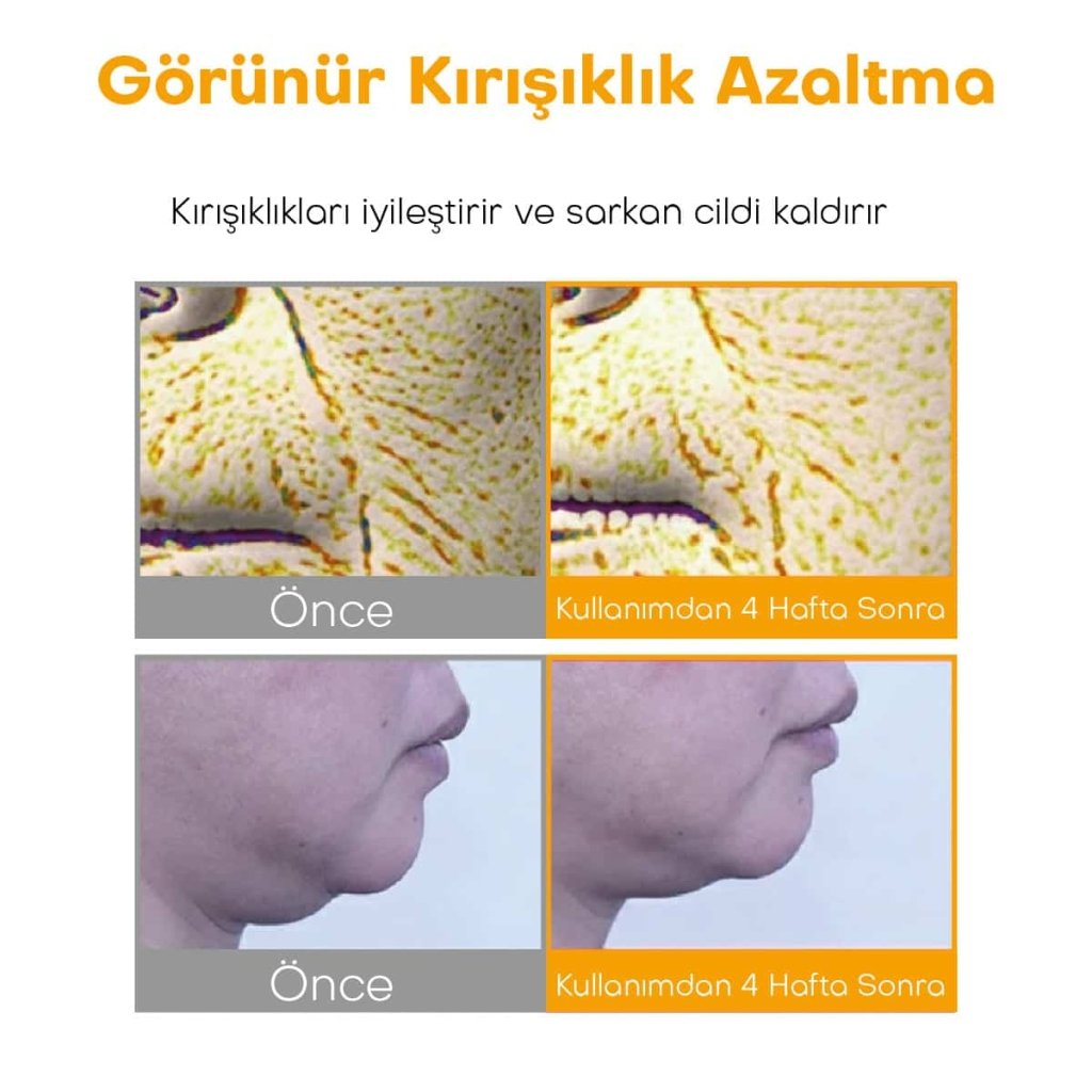 Centellian24 Madeca Cream Season 7 - Yaşlanma Karşıtı Krem – Vionine