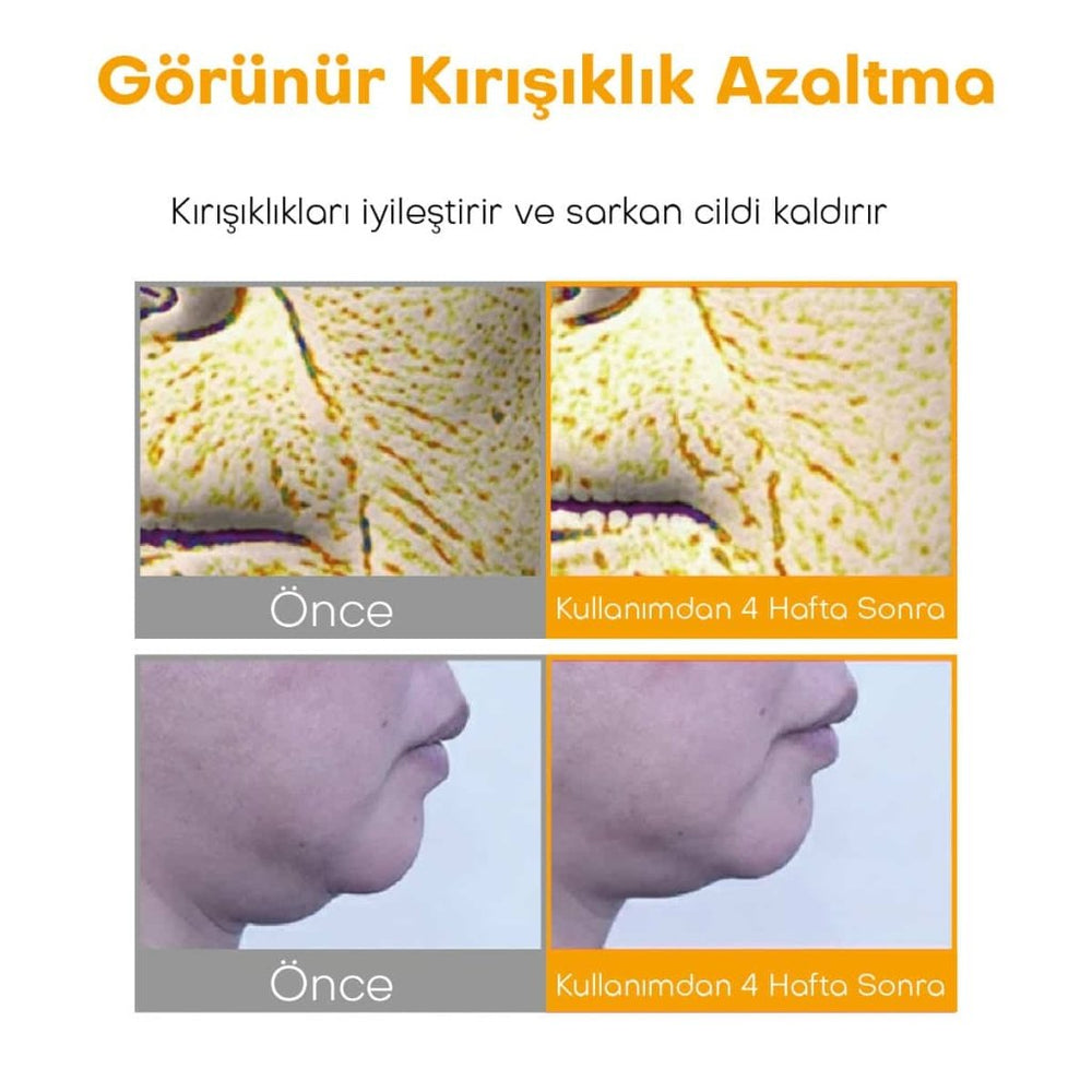Centellian24 Madeca Cream Season 7 uygulama günaşırı gece bakım rutini SPF50