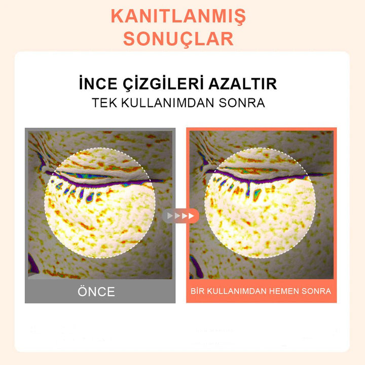 Centellian24 PRN Skin Tightening Glow Gel Mask / Somon DNA İçeren Sıkılaştırıcı Hidrojel Maske (22mlx5 Adet) - Centellian24 - Vionine