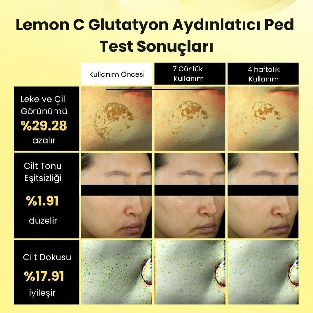 Beplain Lemon C Glutathione Brightening Pad - Aydınlatıcı 70 Adet