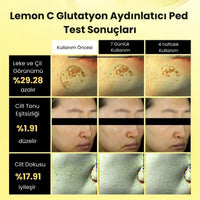 Beplain Lemon C Glutathione Brightening Pad - Aydınlatıcı 70 Adet