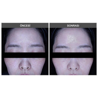 LamuCell Bio Retinol Needle Essence 100 Shots/ Hassas Ciltler İçin Spiküllü Retinol Bakımı 50ml - LamuCell - Vionine