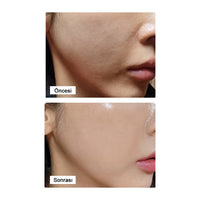 LamuCell PDRN Ampoule / Kırışıklık Karşıtı Bakım Serumu 50ml - LamuCell - Vionine