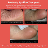 Sungboon Cracked Heel Stick – Yoğun Topuk Bakım Sticki - SUNGBOON EDITOR - Vionine