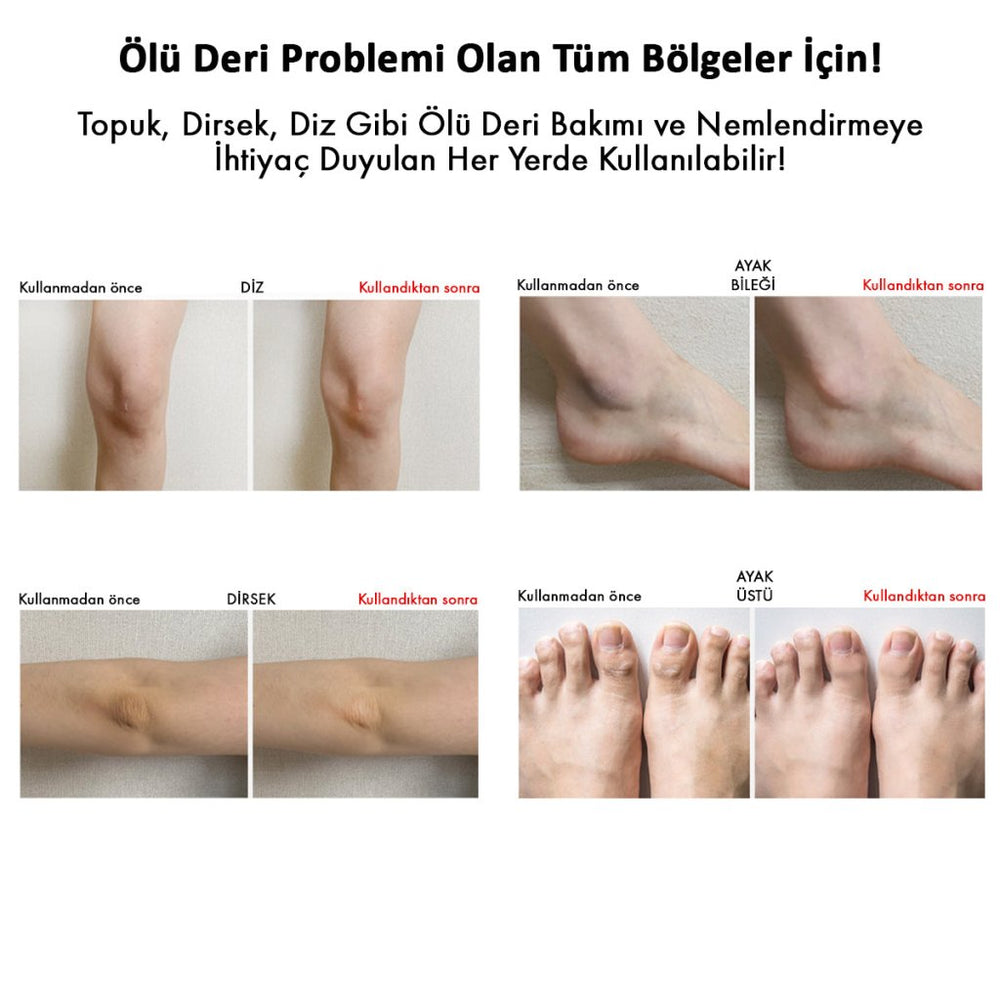 Sungboon Cracked Heel Stick – Yoğun Topuk Bakım Sticki - SUNGBOON EDITOR - Vionine