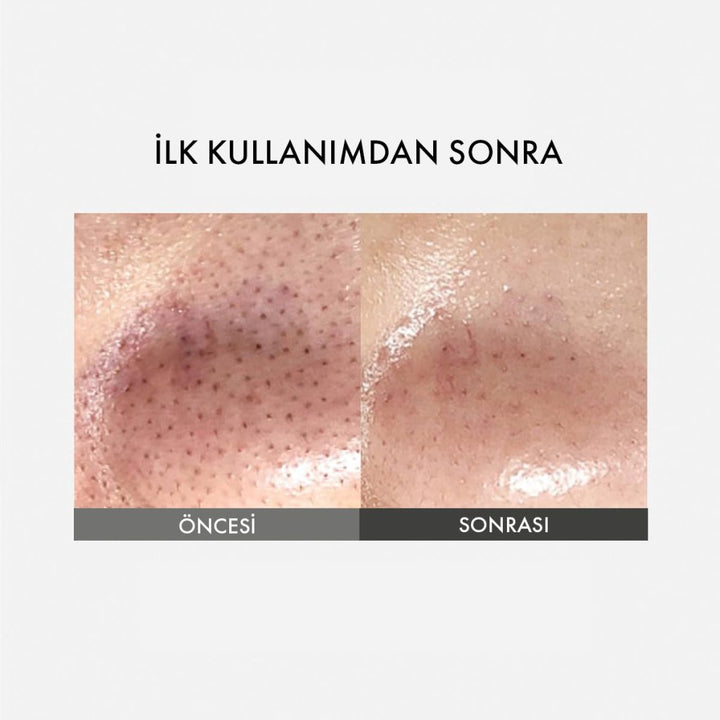 Sungboon Editor Blackhead Melting Clear Pad / Sebum ve Siyah Nokta Temizleyici Burun Bandı - SUNGBOON EDITOR - Vionine