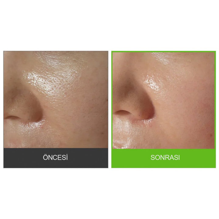 Sungboon Editor Green Tomato Pore Peeling Jumbo Pad 60 Adet - SUNGBOON EDITOR - Vionine