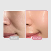 Sungboon Editor Şeffaflaşan Kolejen Maske ( 1 adet ) - SUNGBOON EDITOR - Vionine