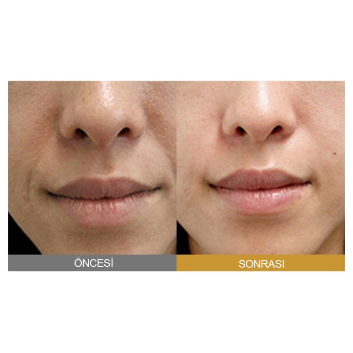 Sungboon Editor Silk Peptide Intensive Lifting Ampoule 35ml - SUNGBOON EDITOR - Vionine