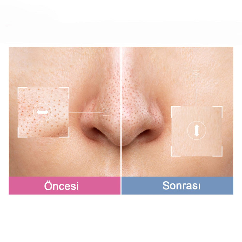 TonyMoly Boncept Retinal Collagen Glow Cream Pack / Gözenek Sıkılaştırıcı Retinal & Kolajen Krem Maske - TONYMOLY & BONCEPT - Vionine
