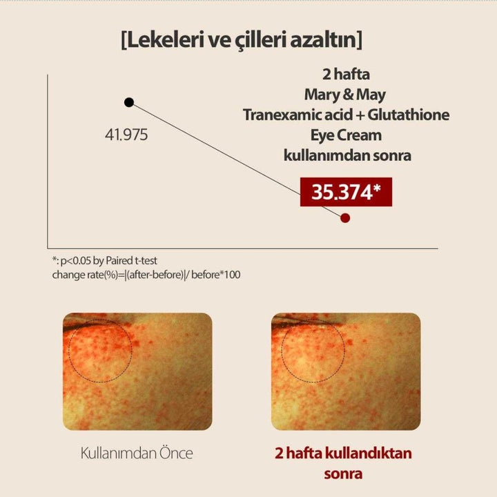 Tranexamic Acid+Glutathion Göz Çevresi Kremi 30 Gr (Kutusuzdur) - Mary & May - Vionine