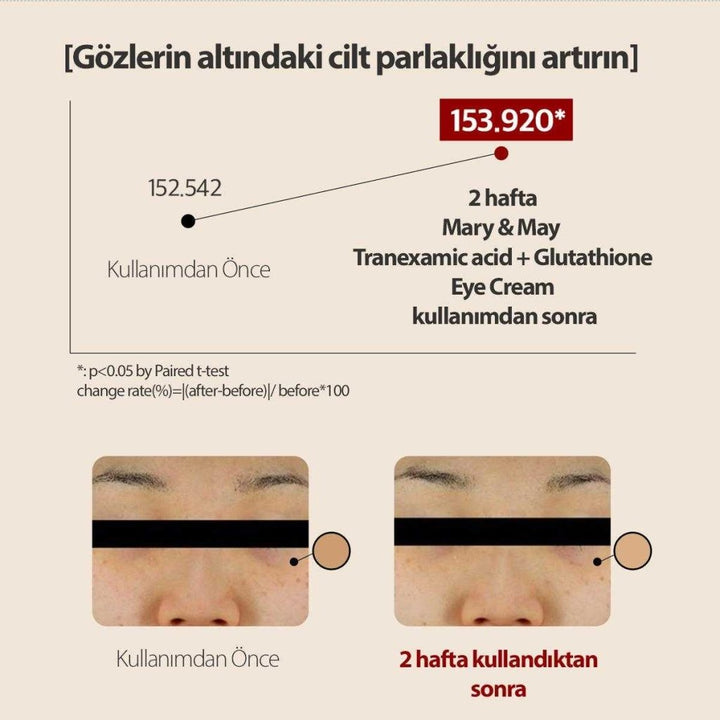 Tranexamic Acid+Glutathion Göz Çevresi Kremi 30 Gr (Kutusuzdur) - Mary & May - Vionine