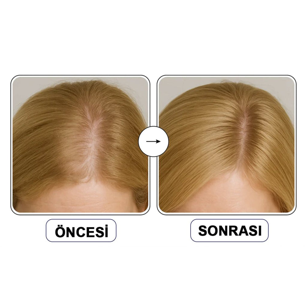 ViveLab Scalp Spioxyl React Shot 800 / Saç Dökülmesine Karşı Güçlendirici Ampul - ViveLab - Vionine