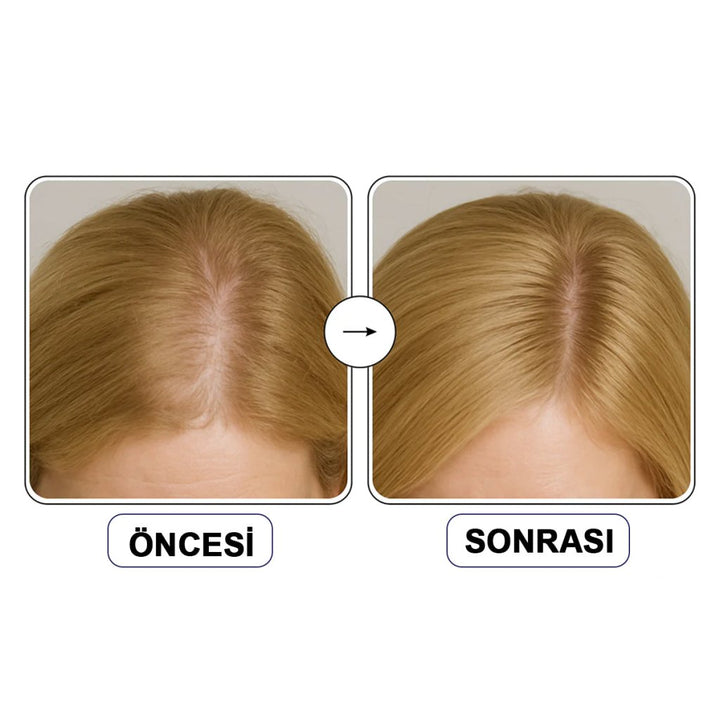ViveLab Scalp Spioxyl React Shot 800 / Saç Dökülmesine Karşı Güçlendirici Ampul - ViveLab - Vionine