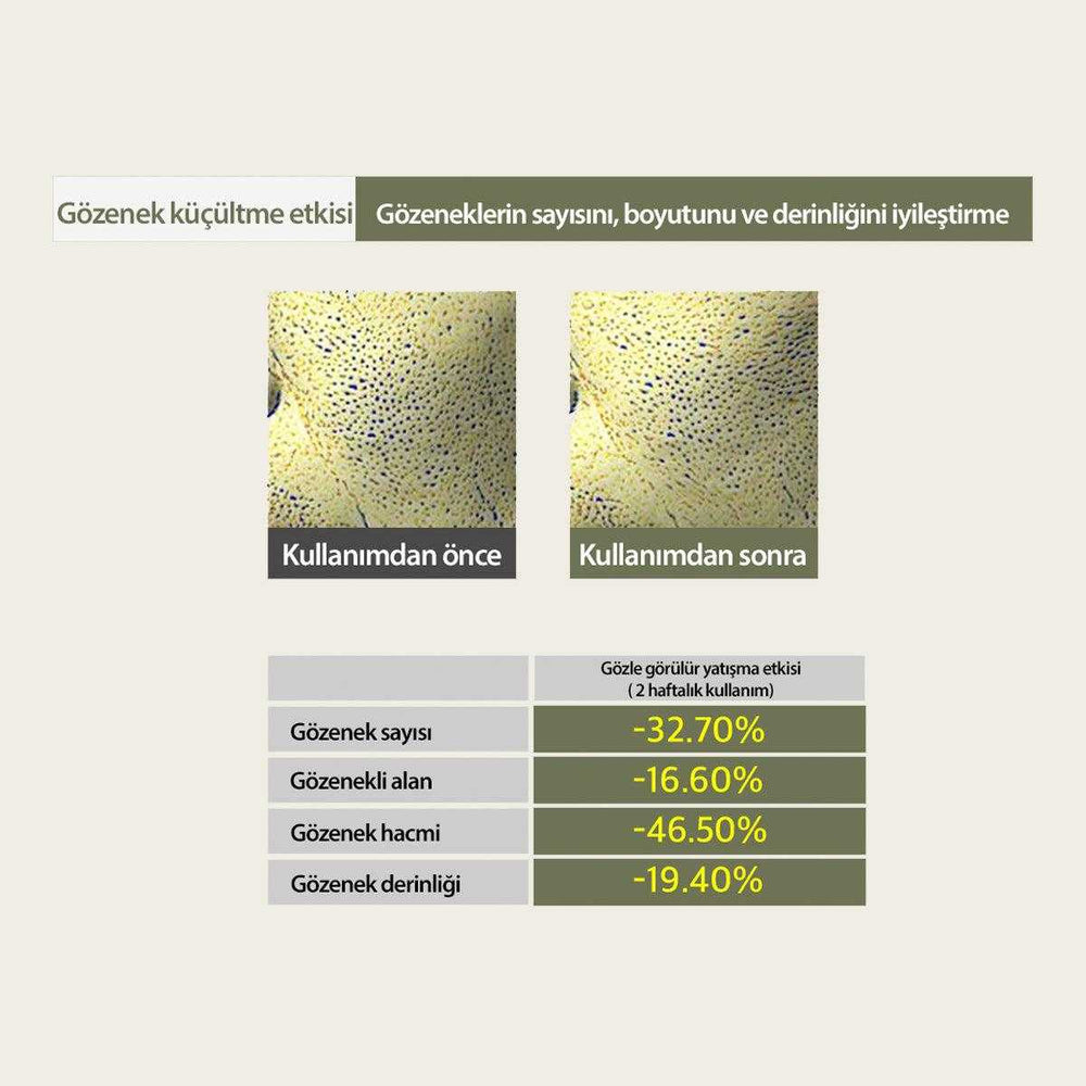 Hassasiyet ve Yağlanma Karşıtı Yatıştırıcı Nemlendirici Sensitive Soothing Gel Blemish Cream 70 gr - Mary & May - Vionine