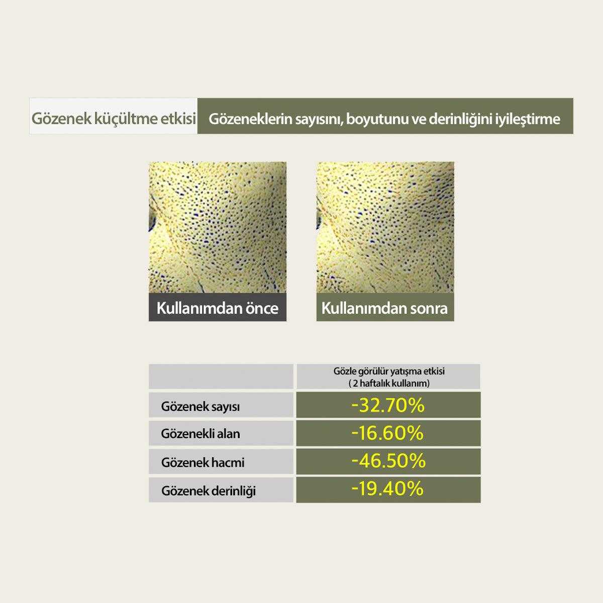 Mary&May Sensitive Gel İle Yatıştırıcı Bakım