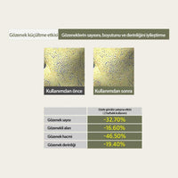 Hassasiyet ve Yağlanma Karşıtı Yatıştırıcı Nemlendirici Sensitive Soothing Gel Blemish Cream 70 gr - Mary & May - Vionine