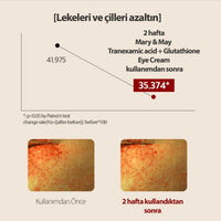 Tranexamic Acid+Glutathion Koyu Halka Karşıtı Aydınlatıcı Göz Çevresi Kremi 30 Gr - Mary & May - Vionine