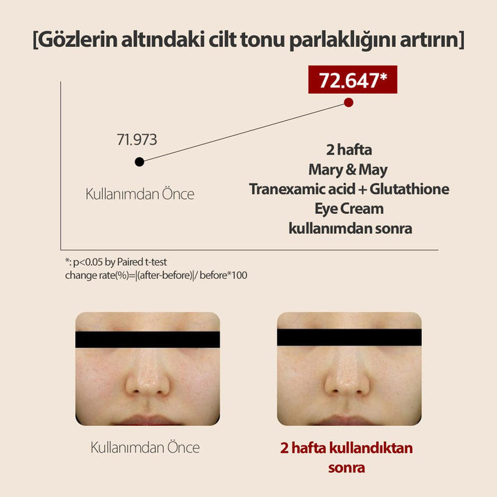 Tranexamic Acid+Glutathion Koyu Halka Karşıtı Aydınlatıcı Göz Çevresi Kremi 30 Gr - Mary & May - Vionine
